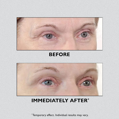 Peter Thomas Roth | Instant Firmx Temporary Eye Tightener | Firm and Smooth the Look of Fine Lines